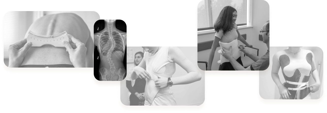 Airy app context: scoliosis care, bracing, and monitoring overview